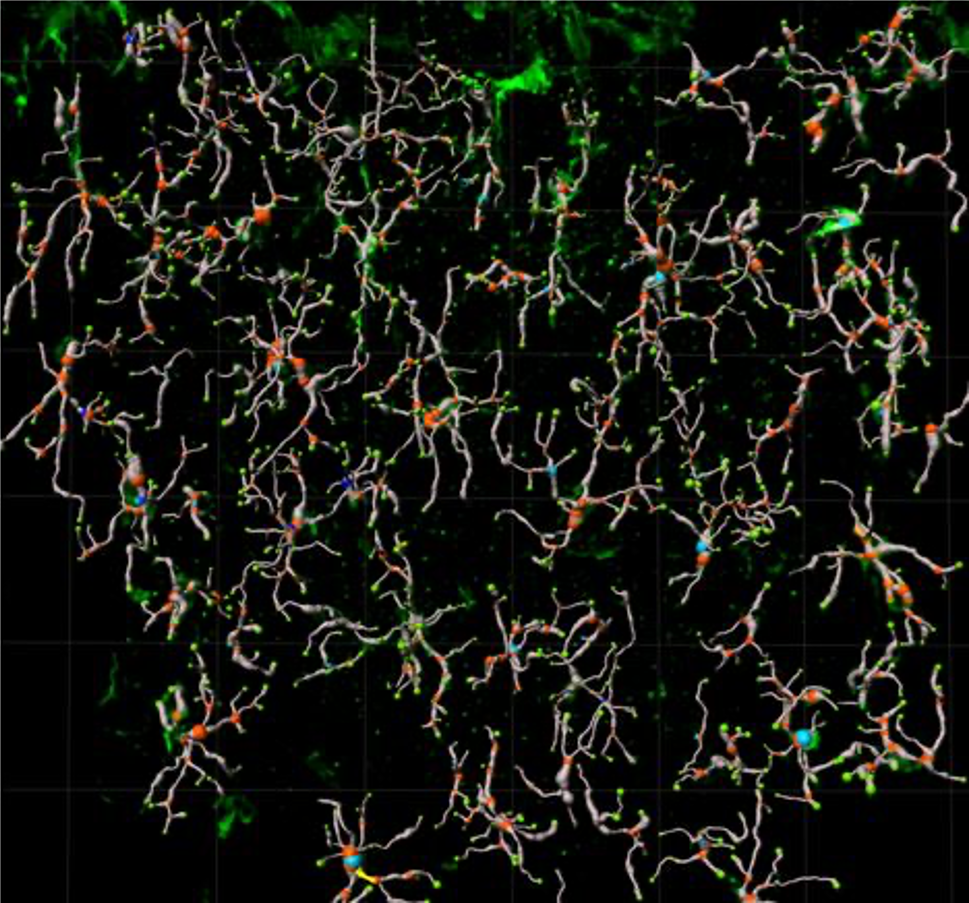 3D reconstruction of microglia filaments